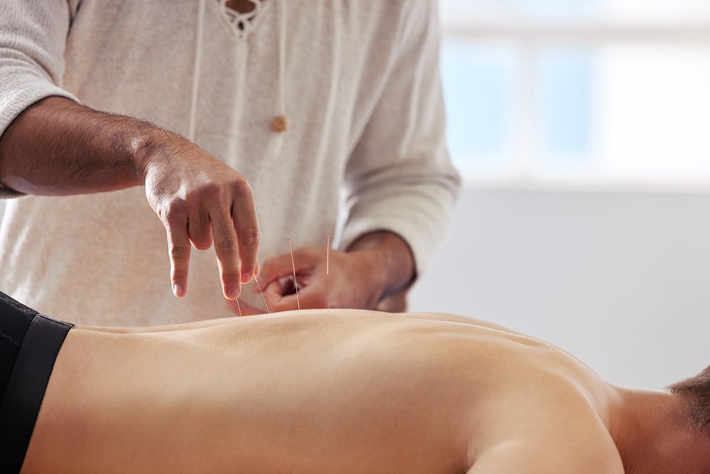 im-so-glad-i-tried-this-shot-of-a-acupuncturist-t-2023-11-27-04-58-32-utc